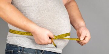 Pacientes com obesidade extrema relatam humilhações chocantes