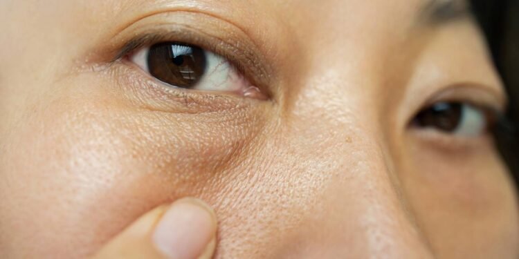 Adotar hábitos saudáveis é a chave para evitar o inchaço ocular ao acordar - Créditos: depositphotos.com / yan_c@bigmir.net