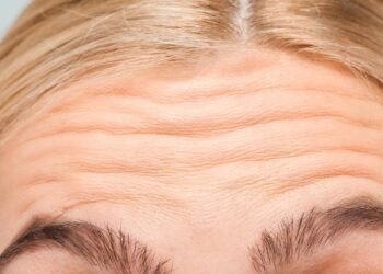 Como se livrar das rugas do pescoço e rejuvenescer a pele sem cirurgia 