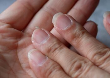 A melhor receita caseira para fortalecer e clarear suas unhas