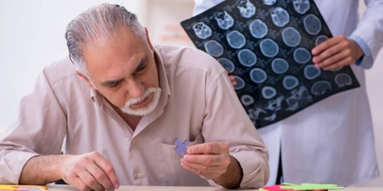 Os melhores hábitos para fortalecer a mente e prevenir o Alzheimer