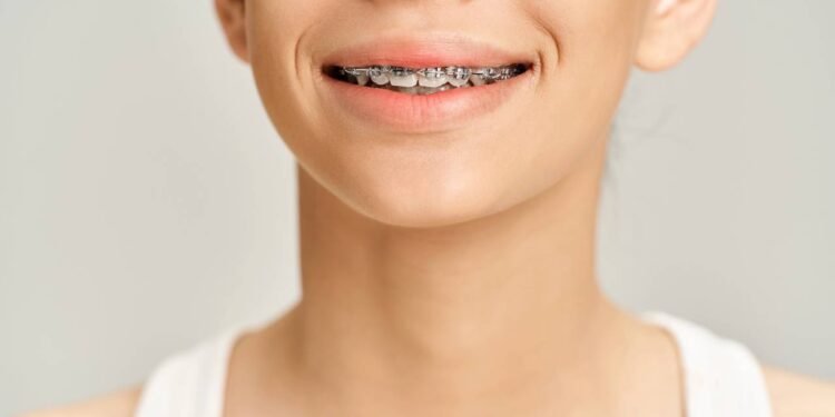 Aparelho - Créditos: depositphotos.com / AllaSerebrina