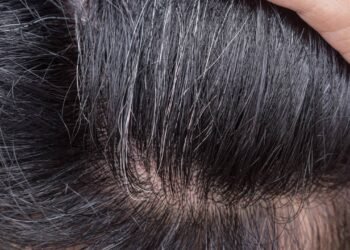 Meus cabelos brancos começaram a sumir depois que adotei esse ritual indiano