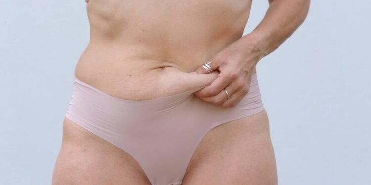 Flacidez - Créditos: depositphotos.com / info.michaelheim-photographer.com