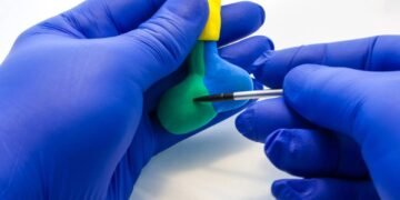 Visão embaçada, fadiga? Pode ser tumor na hipófise