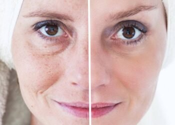 5 hábitos diários que estão envelhecendo sua pele sem você perceber