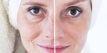 5 hábitos diários que estão envelhecendo sua pele sem você perceber