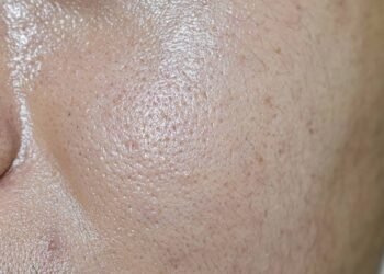 Truque simples para fugir da pele grudenta durante o verão