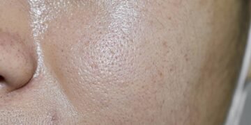 Truque simples para fugir da pele grudenta durante o verão