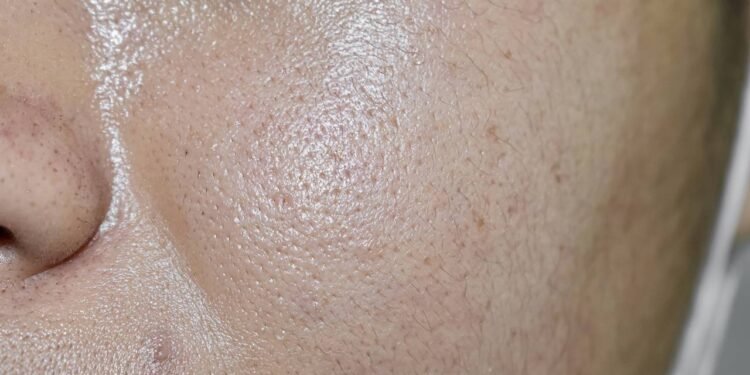 Truque simples para fugir da pele grudenta durante o verão