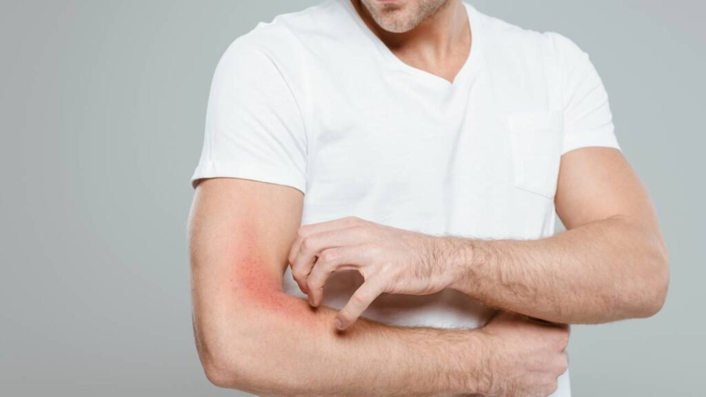 Como proteger a pele sensível do calor sem sofrer com coceiras e vermelhidão