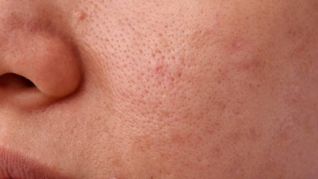 Tomar banho todos os dias nem sempre é saudável, segundo Harvard