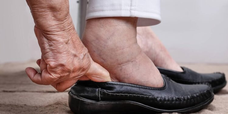 Retenção de Líquidos - Créditos: depositphotos.com / toa55