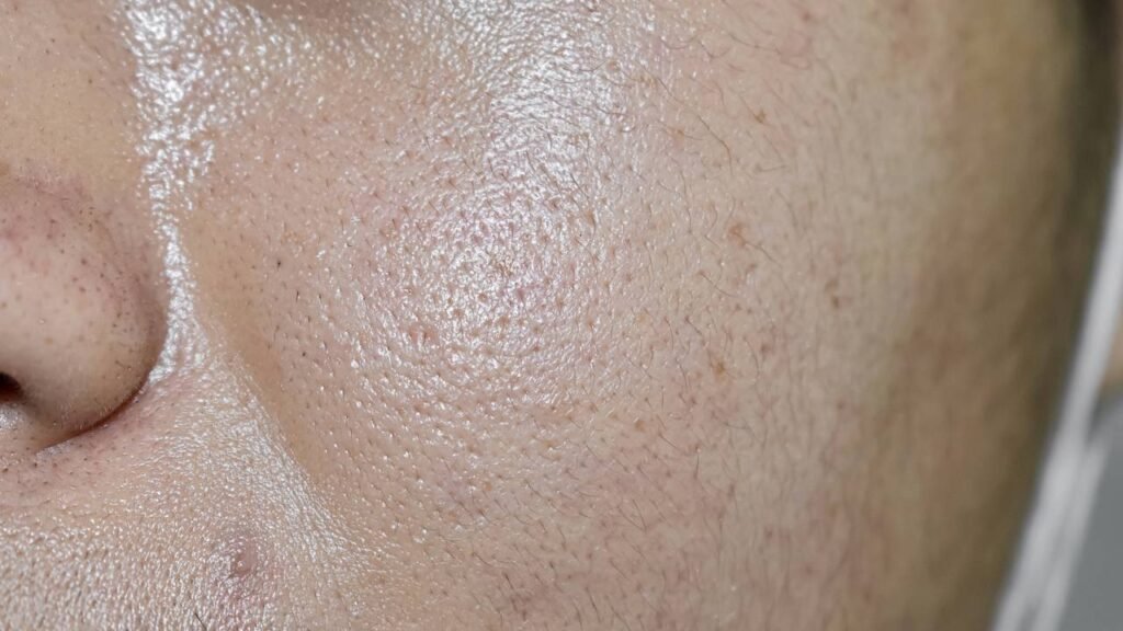 Máscara natural com efeito tensor reduz poros e controla a oleosidade