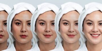 Essa receita simples virou febre entre quem busca pele de porcelana igual das coreanas