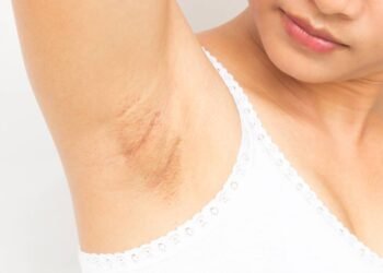 Como ter axilas lisinhas e claras usando apenas cinco ingredientes simples