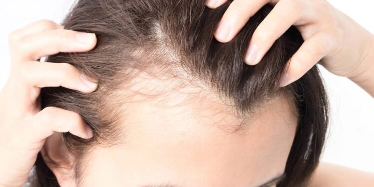 O afinamento do cabelo é uma condição comum e natural - Créditos: depositphotos.com / mraoraor