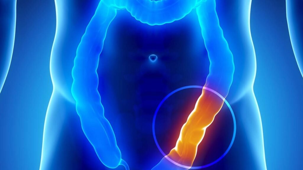Dois sintomas que podem indicar câncer de pâncreas antes do avanço