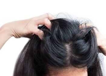 Pare de sofrer com a caspa usando este óleo essencial do jeito certo