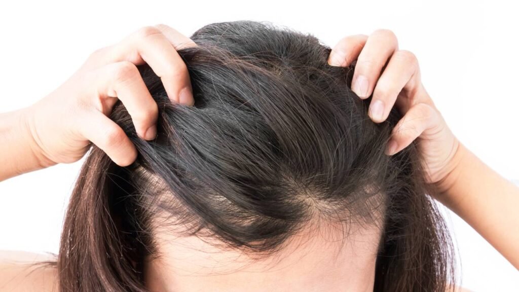 Shampoo famoso é banido pela ANMAT após risco grave à saúde