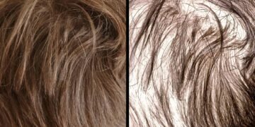 Os óleos essenciais que aceleram o crescimento do cabelo naturalmente