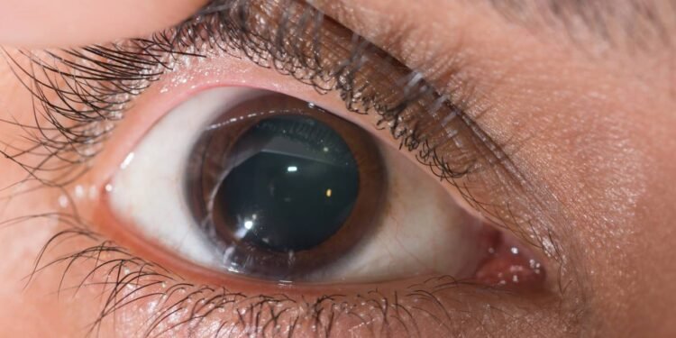 Pupila dilatada - Créditos: depositphotos.com / arztsamui