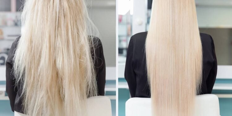 Já a nutrição é um tratamento voltado para a reposição de lipídios - Créditos: depositphotos.com / ParStud