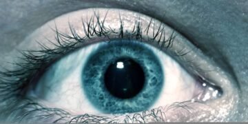 Entenda o que pode causar manchas escuras na sua visão