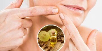 Como usar óleo de semente de uva para remover cravos