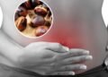Castanhas causam inchaço? Saiba o que fazer para evitar o desconforto