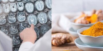 Como uma especiaria dourada pode blindar seu coração e cérebro ao mesmo tempo