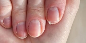 Minhas unhas quebravam o tempo todo até eu mudar um simples hábito