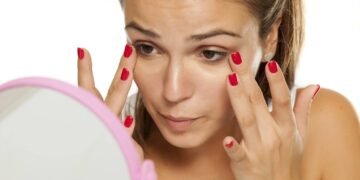 Tinha olheiras profundas há anos, esse truque caseiro fez milagres no meu rosto