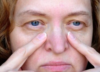 Diga adeus às pálpebras caídas e realce seu olhar com técnicas de maquiagem simples