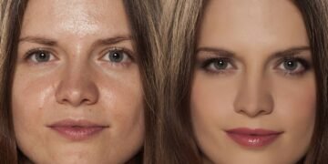 O truque mais simples para manter a pele bonita e sequinha nos dias quentes