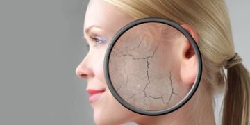 O aliado poderoso para quem sofre com descamação e pele muito grossa