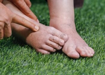 Como fazer seu corpo parar de reter líquidos usando estas ervas poderosas