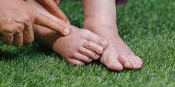 Como fazer seu corpo parar de reter líquidos usando estas ervas poderosas