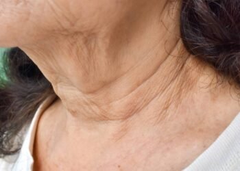 Como reduzir as linhas finas no pescoço e colo usando esse creme caseiro