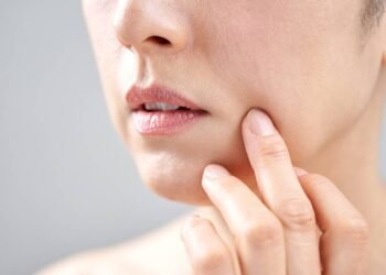 Passei esse óleo natural por 30 dias e as linhas da boca sumiram