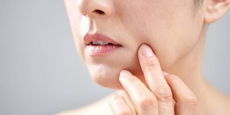 Passei esse óleo natural por 30 dias e as linhas da boca sumiram