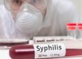 O Ministério da Saúde registrou 36.702 casos de sífilis este ano, com aumentos acentuados entre os jovens de 15 a 39 anos