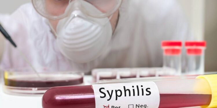 O avanço da sífilis revela cenário que preocupa a saúde pública - Créditos: depositphotos.com / vchalup2