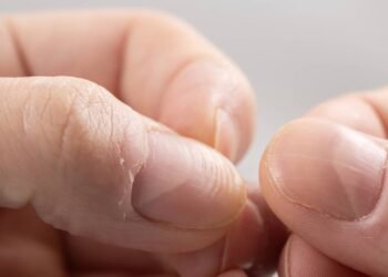 A solução acessível para unhas que descamam e quebram o tempo todo