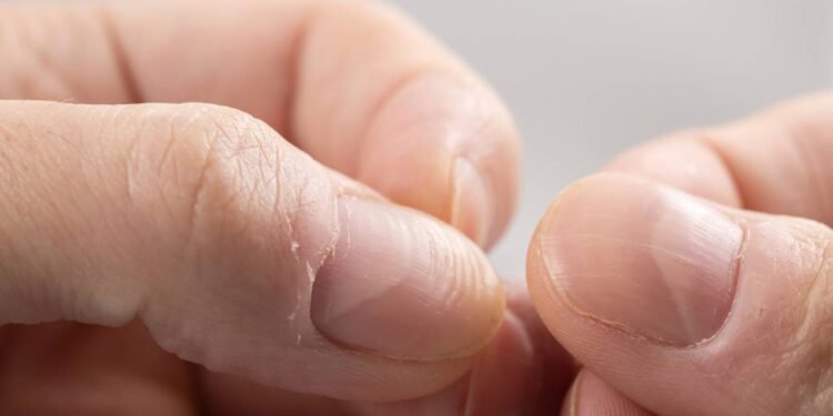 Especialistas em manicures destacam que o uso de óleos vegetais para cutículas - Créditos: depositphotos.com / eliosdnepr@gmail.com