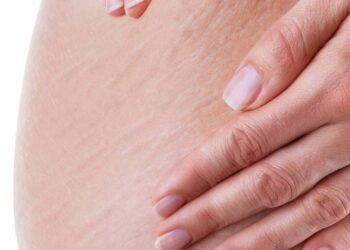 Incomodada com a celulite? Veja como suavizar os furinhos com café e gel