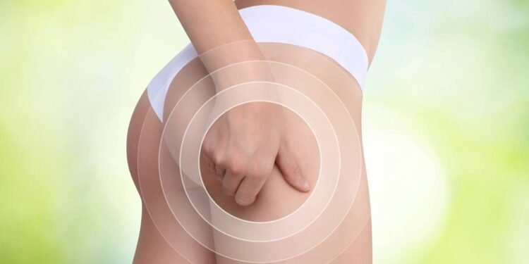 Como reduzir a celulite sem gastar com drenagem ou cremes caros