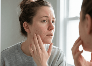 Acabe com a pele ressecada usando produtos certos no chuveiro