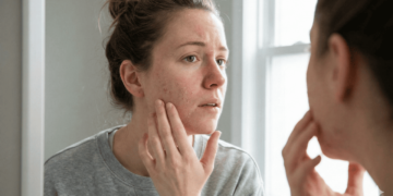 Acabe com a pele ressecada usando produtos certos no chuveiro