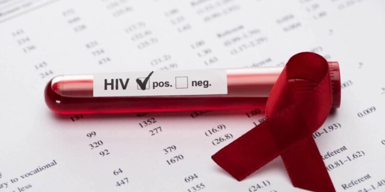 HIV - Créditos: depositphotos.com / VadimVasenin